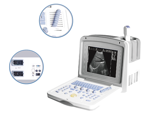 endoscopic ultrasound price