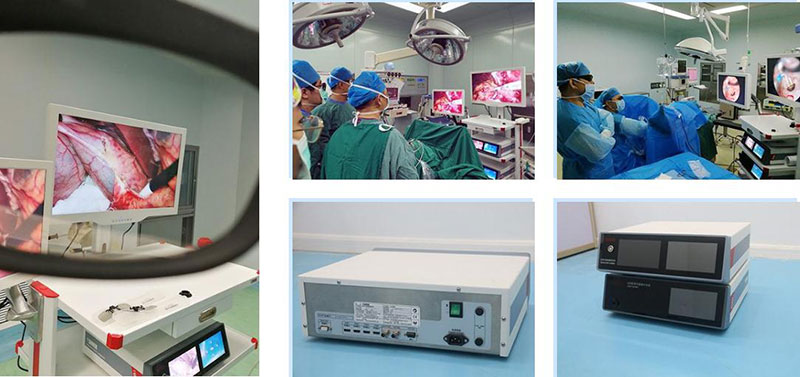 3D Medical Endoscope Camera